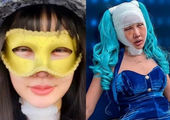 Selesai Operasi Wajah, Tampilan Lucinta Luna Berubah, Sejumlah Netizen Kaget Wajahnya Mirip Cewek Korea
